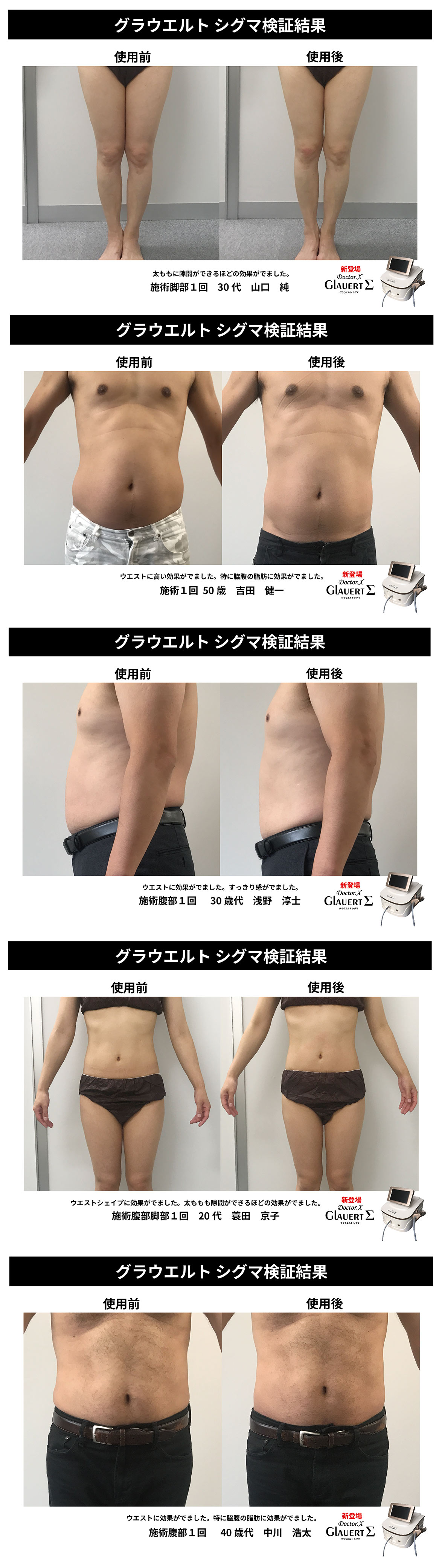 シグマ01